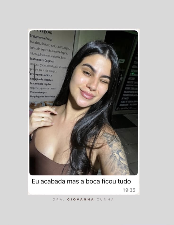 Foto de paciente com mensagem dizendo que gostou do resultado dos lábios